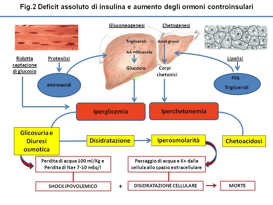 Cetosis diabetica proceso fisiológico